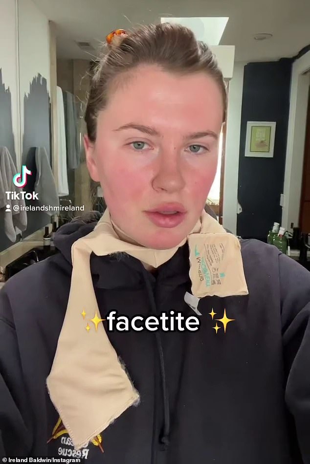 Őszinte: Ireland Baldwin arról beszél, hogy miért esik át ebben a hónapban a FaceTite-en, egy minimálisan invazív kozmetikai eljáráson, amely hasonlít egy sebészeti arcplasztikai beavatkozáshoz.