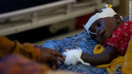 Fatima Abdullah megérinti 8 hónapos kislányát, Abdit, aki júliusban súlyos alultápláltság miatt került kórházba Szomáliában.